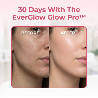 Glow Pro™